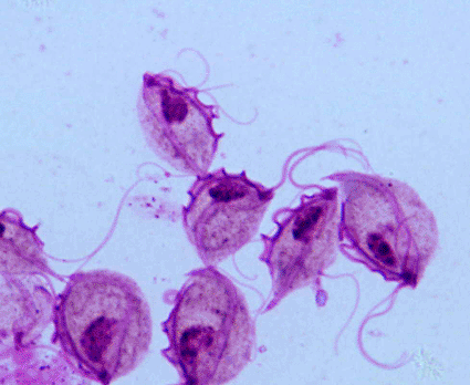 Image:Trichomonas vaginalis (photo courtesy of Raymond Jacobson).